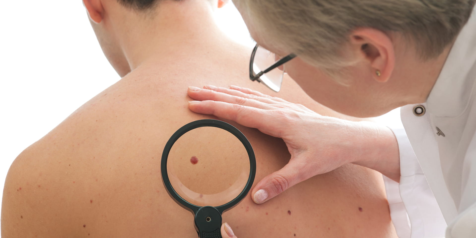 dermatologist examining a mole on patient's back