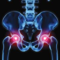 X-Ray view of hips | Doylestown Health