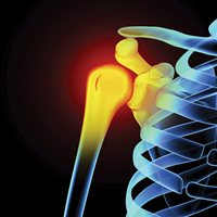 X-ray view of a shoulder | Doylestown Health